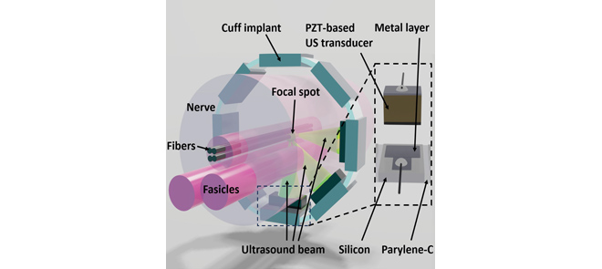 Illustrative Image